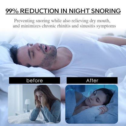 Anti-Snoring Nose Breathing Patch